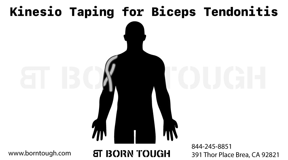 Kinesio Taping per tendinite del bicipite