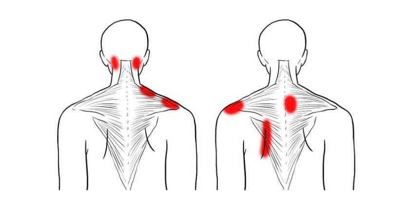 3 migliori esercizi per il mal di schiena